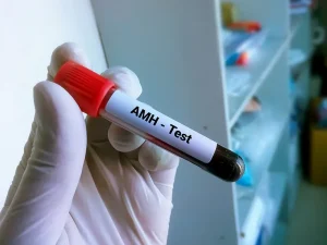 هورمون AMH در آزمایش